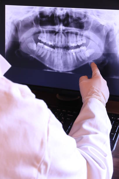 Best Emergency Dental Extractions in Northwest Harborcreek, PA