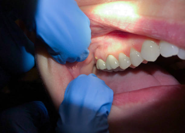 Best Orthodontic Emergency Dentist in Northwest Harborcreek, PA